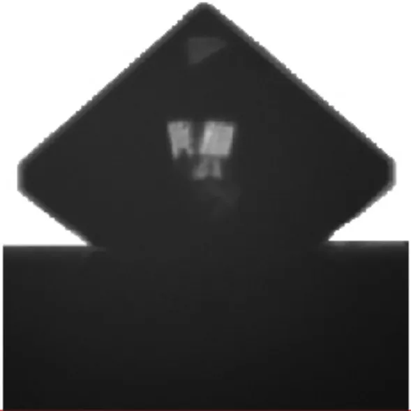 تشوّه في الطرف