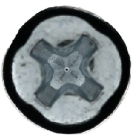 انسداد التجويف المتقاطع